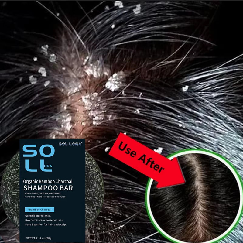 Hair Care Dandruff - Jabón para tratamiento del cabello anticaspa