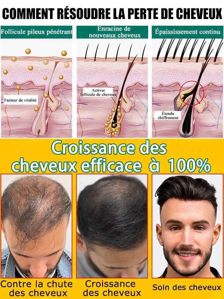 Líquido Nutritivo Diario para  - Hair Care For Hair Fall reseña y precio